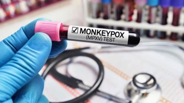 Monkeypox Menace