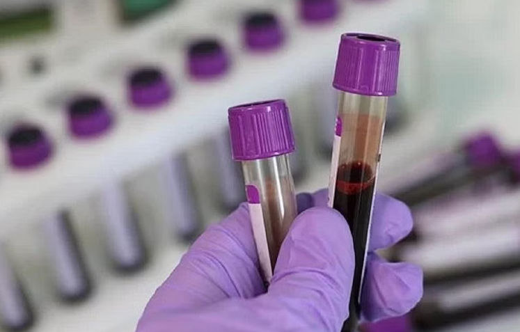 Influenza A B and Corona virus test kit