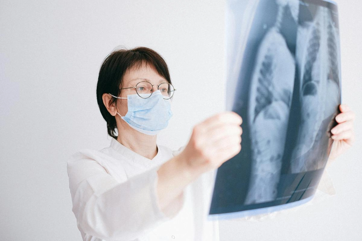 The DNA reveals link between the contamination and the cancer of lung in no smokers