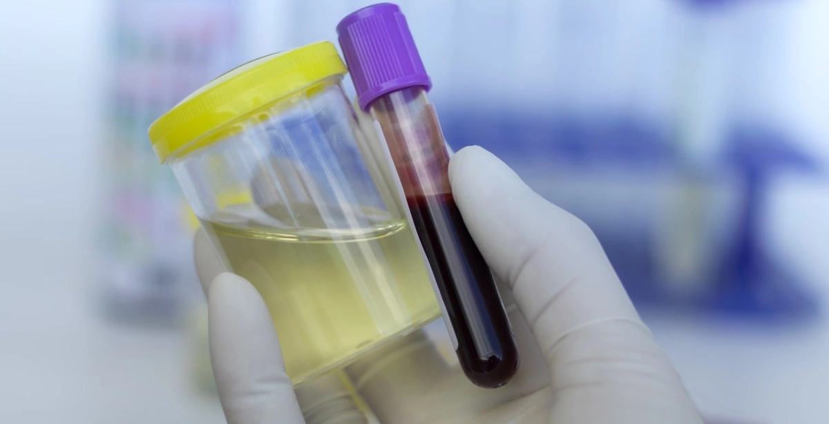 Urine and blood tests are screening tests how are they different which should do