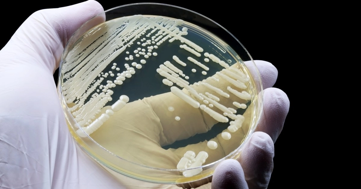 Hongo mortal Candida auris se est propagando por todo Estados Unidos