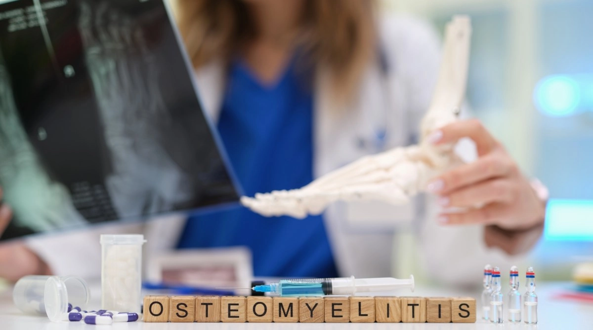 Osteomielitis una infeccin grave causada por una bacteria cmo se trata