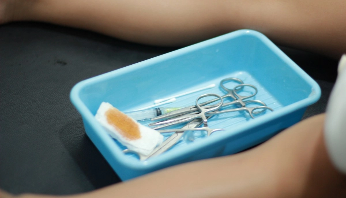 Circumcision in thespotlight health guidelines consider it potentially harmful