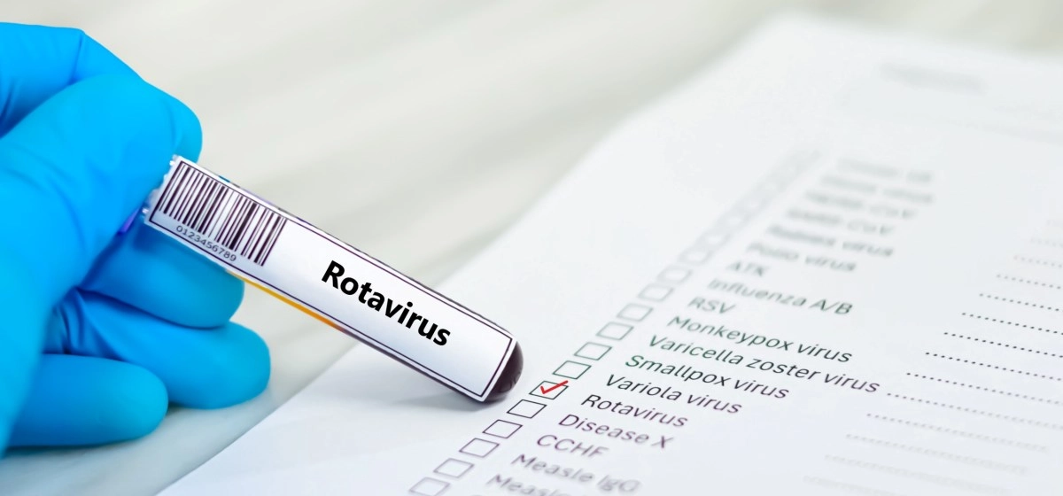 Highly contagious digestive virus is spreading rapidly throughout the United States