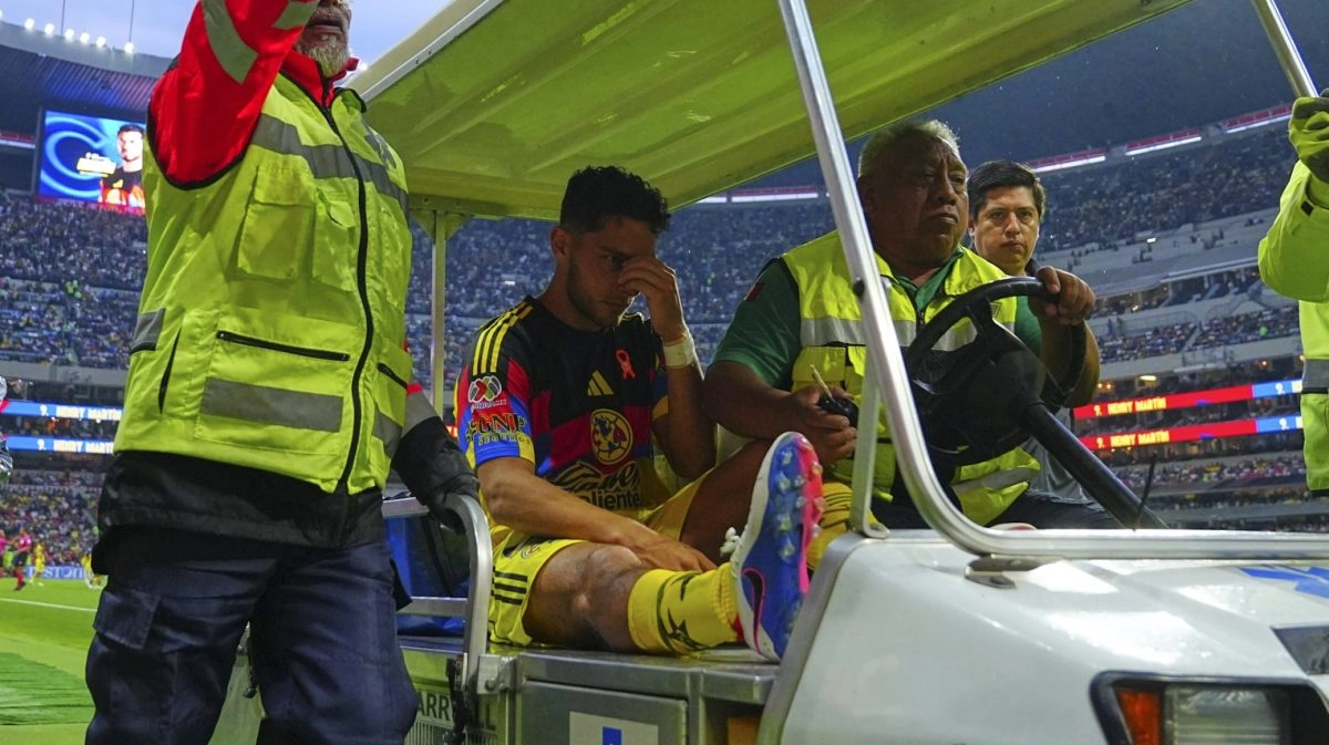 Concussion fracture and eye injury America reveals medical part of Sebastin Cceres