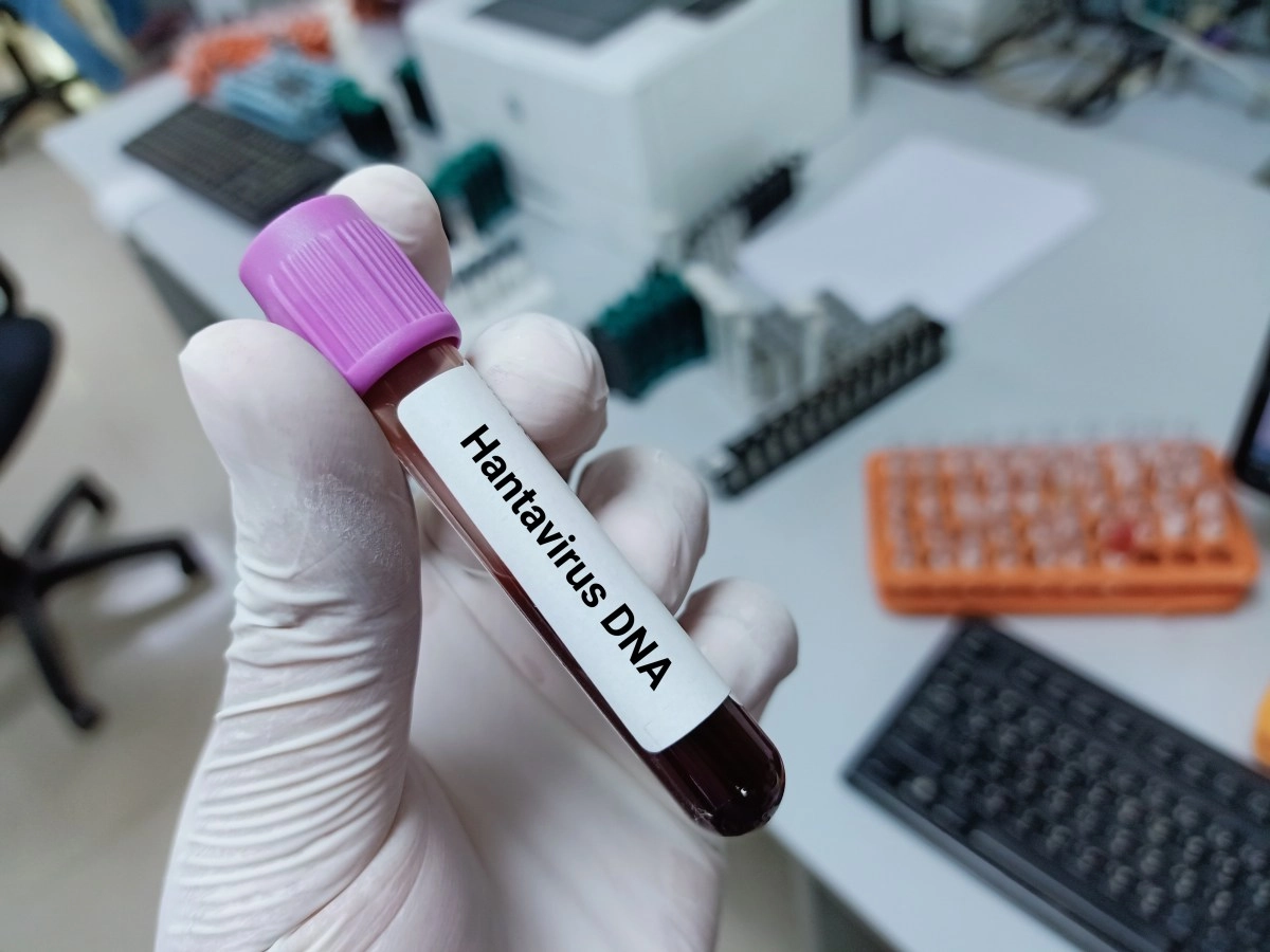 What are the risks of hantavirus in the US This does the CDC say