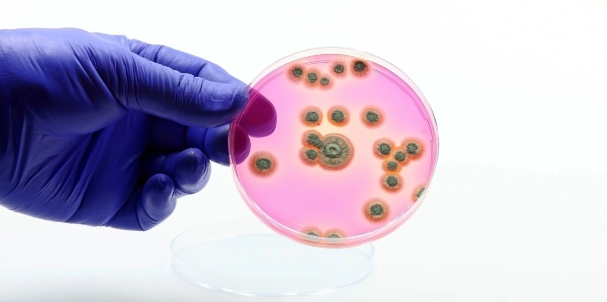 Alarming increase of candidemia in the US reveals study
