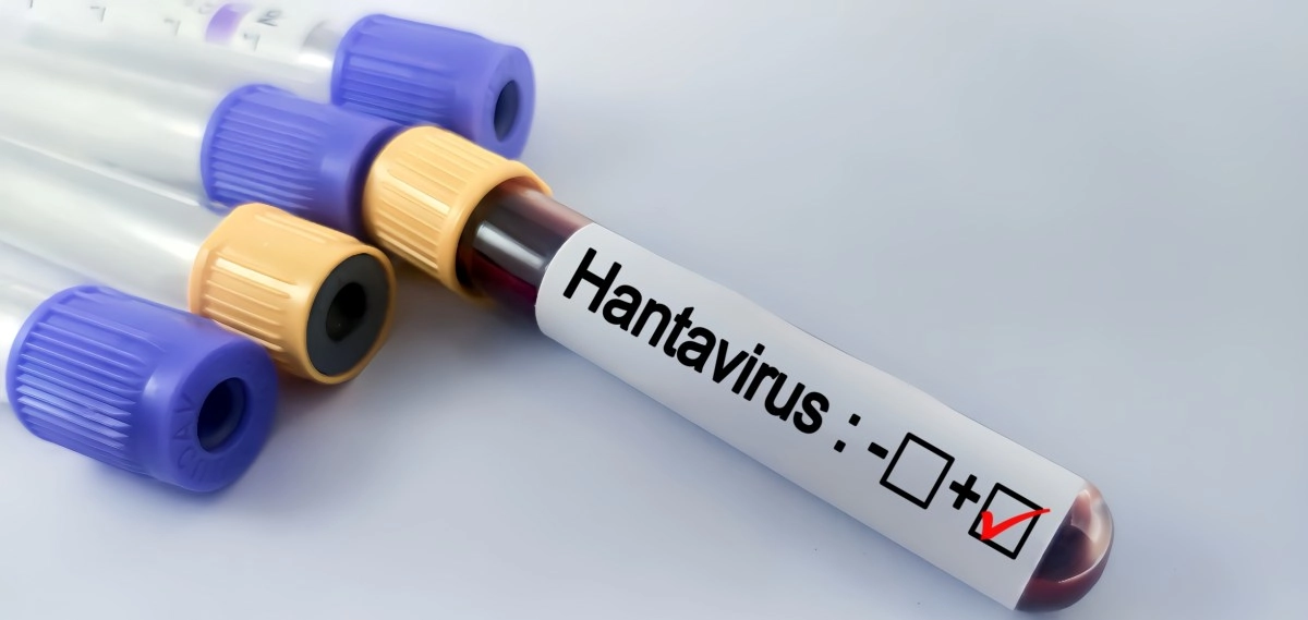 Revelations about the Andes strain first genetic analysis of the cruise hantavirus rules out that it is due to mutations