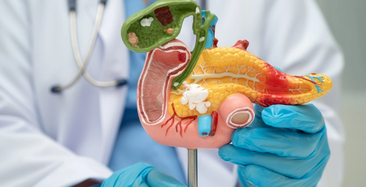 Experimental pill that promises new hope for deadly pancreatic cancer accelerated