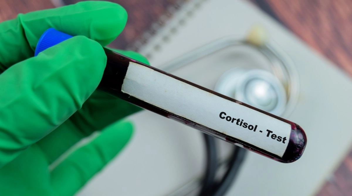 Cortisol Hit Ways to Reduce Chronic Stress and Improve Energy