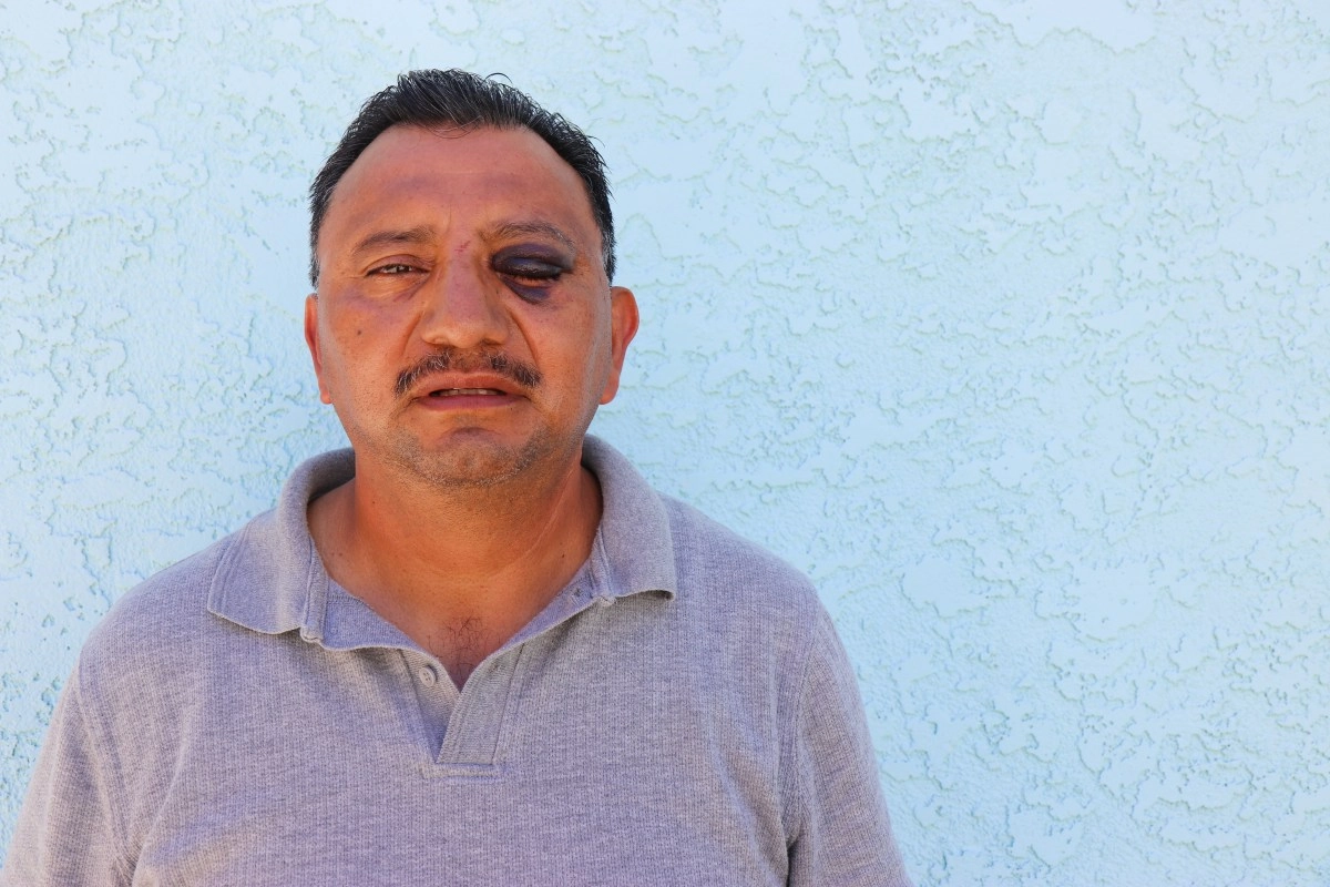 Long Beach street vendor suffers terrible attack