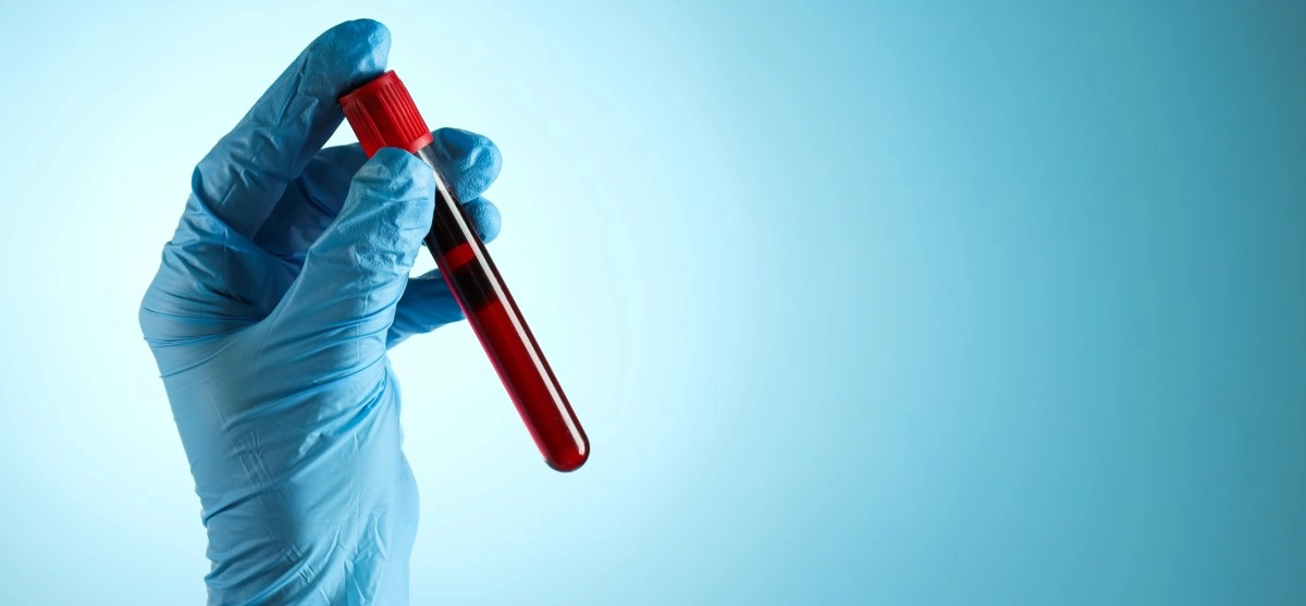 With AI support a blood test detects hidden heart risks up to 15 years in advance
