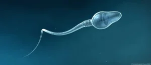 Artificial intelligence achieves the first pregnancy in a case of severe male infertility