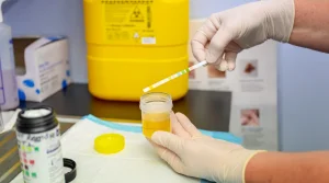 Revolutionary advance in the diagnosis of prostate cancer: new urine test improves patient follow-up