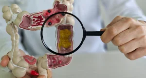 Impact of inflammatory bowel disease: the importance of early detection