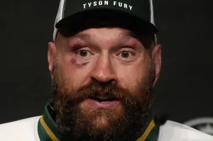 Will there be a fight between Eddie Hearn and Dana White? Tyson Fury offers his help