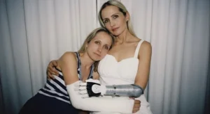 A rare condition led her to lose her arm after routine surgery: Wioletta shares her story of resilience