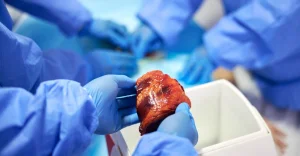 “Death by organ donation”, a new proposal that raises concern: medical vultures hunting corpses?