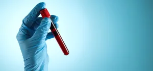 With AI support, a blood test detects hidden heart risks up to 15 years in advance
